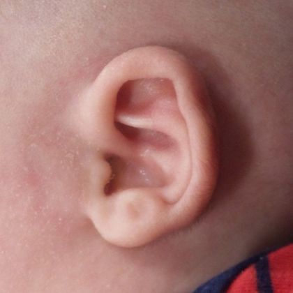 Gallery | Ears R Us | NYC and Trumbull, CT