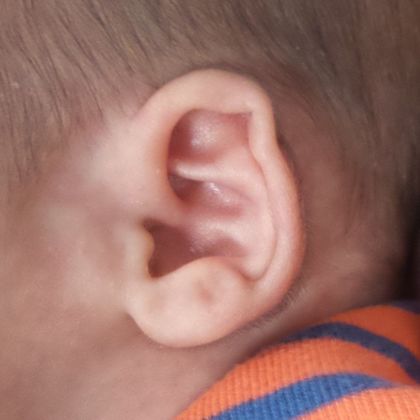 Gallery | Ears R Us | NYC and Trumbull, CT